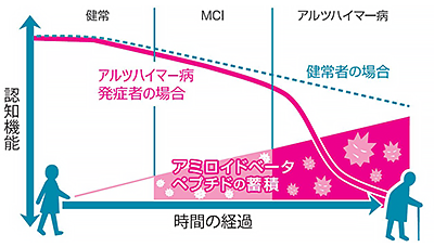 アミロイドベータペプチドの蓄積