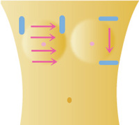 乳腺超音波