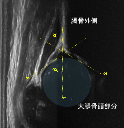 整形外科・血管領域超音波