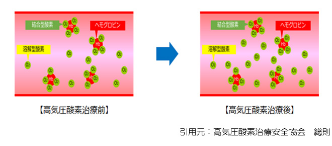 図：高気圧酸素治療前と治療後